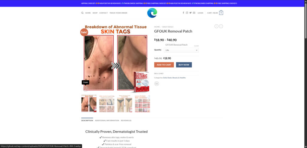 Gfouk Removal Patch Scam EXPOSED: The Skin Tag Patch Con 3 2 17