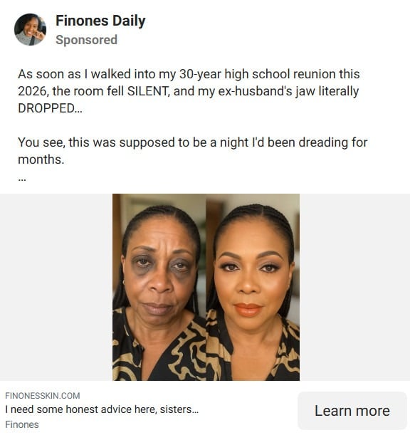 Finones Skin Vitamin Serum EXPOSED - Scam Ads & Red Flags 3 x 21