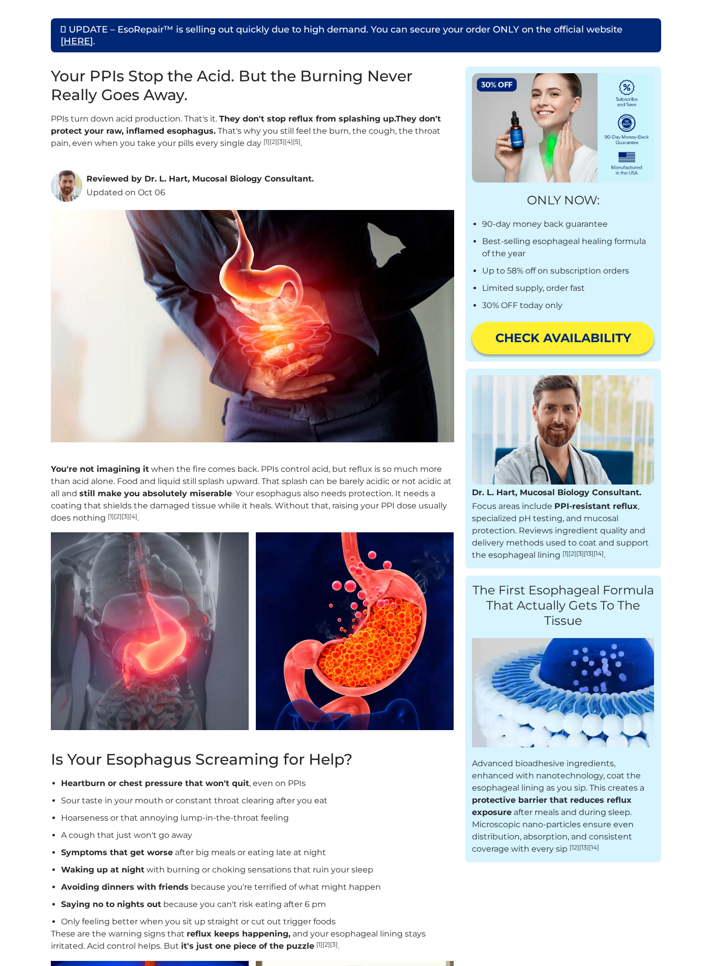 Acid Reflux Repair Drops Scam Exposed: Fake or Real? Full Investigation 1 EsoRepair advertorial promoting acid reflux repair drops and subscription savings