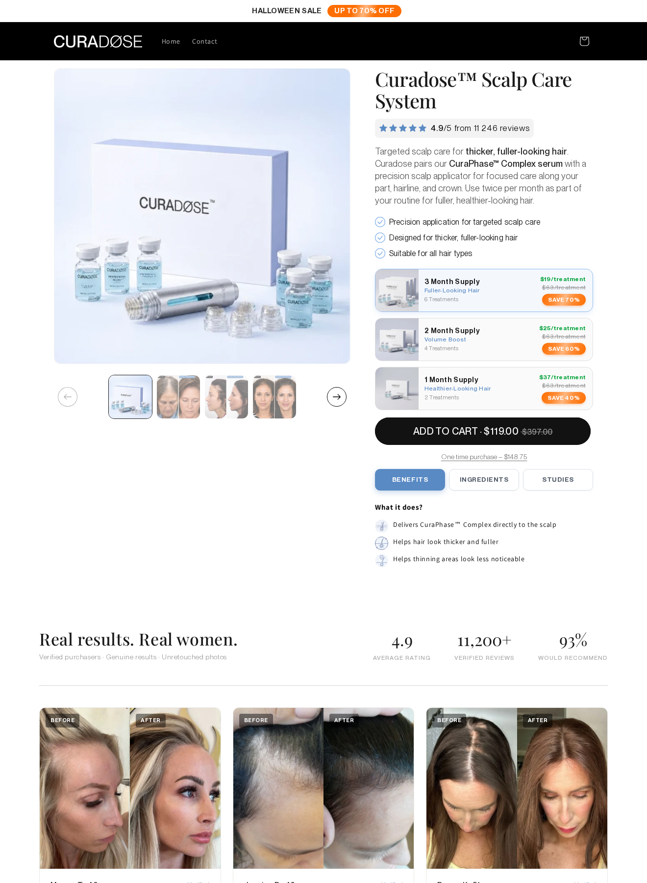 Curadose Scalp Care System product page showing serum, scalp applicator, supply packages and differing price labels